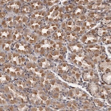 Anti-PLEKHF2 antibody produced in rabbit Prestige Antibodies&#174; Powered by Atlas Antibodies, affinity isolated antibody, buffered aqueous glycerol solution