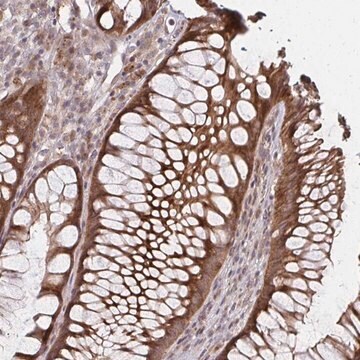 Anti-ZNF285 antibody produced in rabbit Prestige Antibodies&#174; Powered by Atlas Antibodies, affinity isolated antibody, buffered aqueous glycerol solution