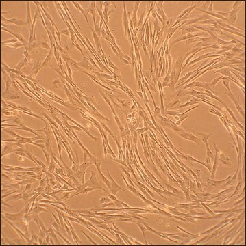 Canine Coronary Artery Smooth Muscle Cells: CnCASMC (Cryovial)