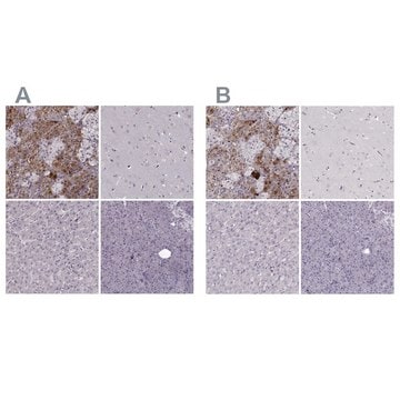 Anti-PNMT antibody produced in rabbit Prestige Antibodies&#174; Powered by Atlas Antibodies, affinity isolated antibody, buffered aqueous glycerol solution