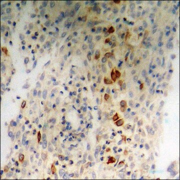 Anti-phospho-Nibrin (pSer278) antibody produced in rabbit affinity isolated antibody