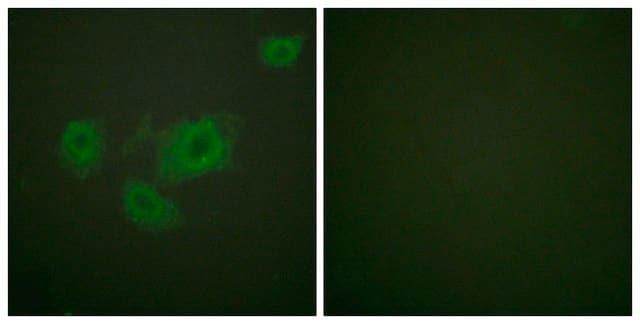 Anti-KIR6.2 (PHOSPHO-THR224) affinity isolated antibody