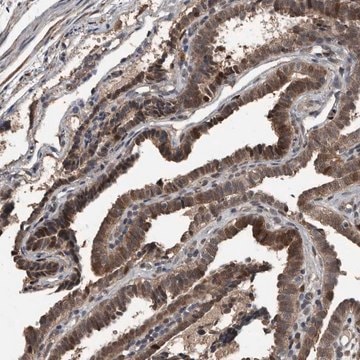 Anti-FSBP antibody produced in rabbit Prestige Antibodies&#174; Powered by Atlas Antibodies, affinity isolated antibody, buffered aqueous glycerol solution