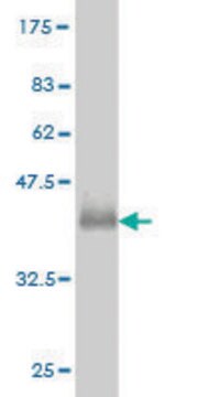 ANTI-GUCY2D antibody produced in mouse clone 5E10, purified immunoglobulin, buffered aqueous solution