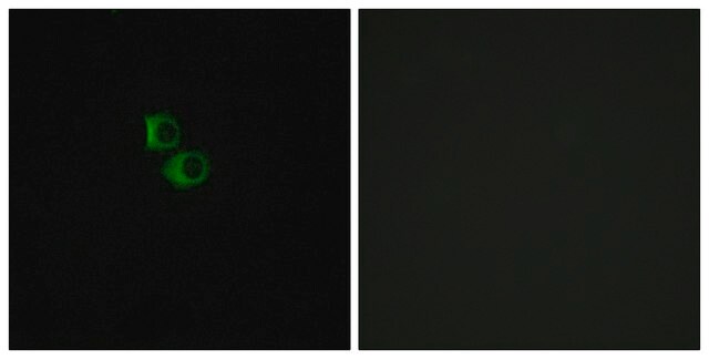 Anti-OR51B6 antibody produced in rabbit affinity isolated antibody