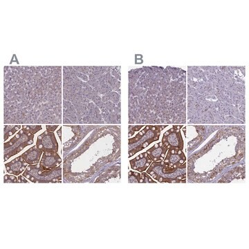 Anti-CORO2A antibody produced in rabbit Prestige Antibodies&#174; Powered by Atlas Antibodies, affinity isolated antibody, buffered aqueous glycerol solution