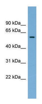 Anti-IFI44 antibody produced in rabbit affinity isolated antibody