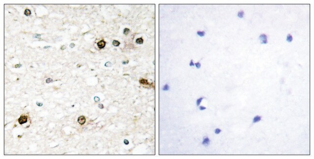 Anti-NAB2 antibody produced in rabbit affinity isolated antibody