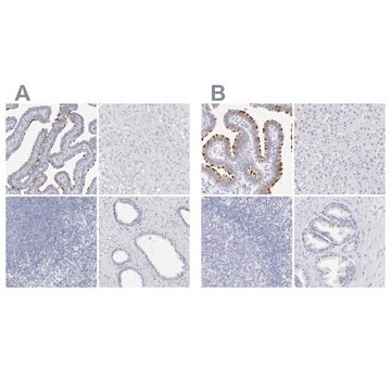 Anti-CFAP57 antibody produced in rabbit Prestige Antibodies&#174; Powered by Atlas Antibodies, affinity isolated antibody, buffered aqueous glycerol solution