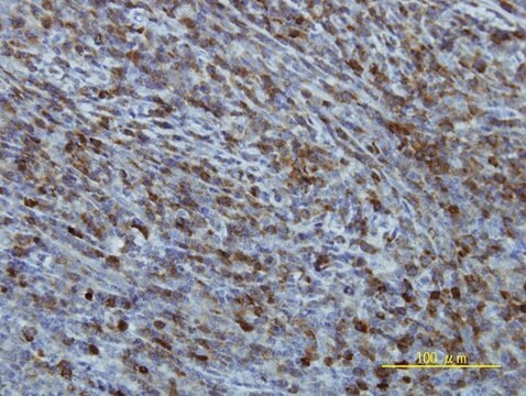 Monoclonal Anti-EIF2B2 antibody produced in mouse clone 5B12-E10, purified immunoglobulin, buffered aqueous solution