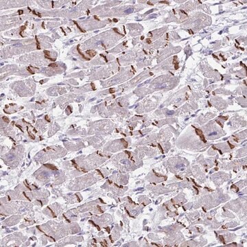 Anti-MRM2 antibody produced in rabbit Prestige Antibodies&#174; Powered by Atlas Antibodies, affinity isolated antibody, buffered aqueous glycerol solution