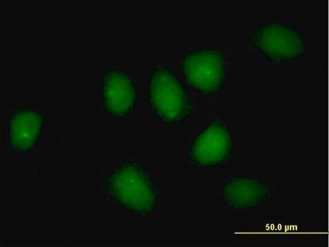 Anti-NR3C1 antibody produced in rabbit purified immunoglobulin, buffered aqueous solution