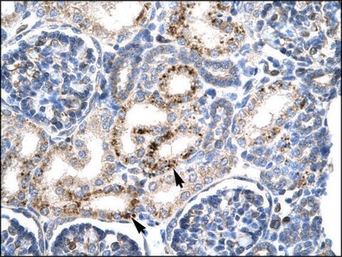 Anti-PAX4 antibody produced in rabbit affinity isolated antibody