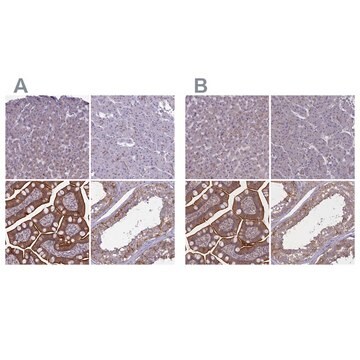 Anti-CORO2A antibody produced in rabbit Prestige Antibodies&#174; Powered by Atlas Antibodies, affinity isolated antibody, buffered aqueous glycerol solution