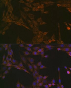 Anti-SMYD3 antibody produced in rabbit