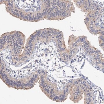 Anti-NUDCD2 antibody produced in rabbit Prestige Antibodies&#174; Powered by Atlas Antibodies, affinity isolated antibody, buffered aqueous glycerol solution