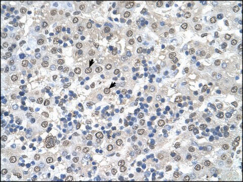 Anti-CDR2 antibody produced in rabbit IgG fraction of antiserum