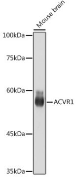 Anti-ACVR1 Antibody, clone 1J7G4, Rabbit Monoclonal