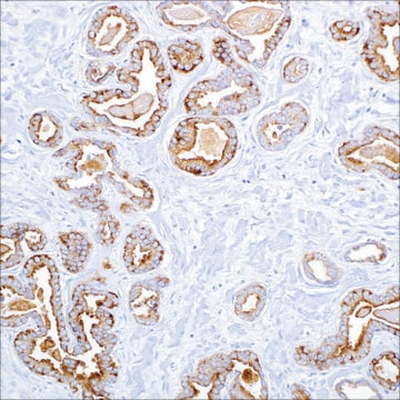 Cytokeratin, LMW (AE1) Mouse Monoclonal Antibody