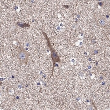 Anti-CLVS1 antibody produced in rabbit Prestige Antibodies&#174; Powered by Atlas Antibodies, affinity isolated antibody, buffered aqueous glycerol solution