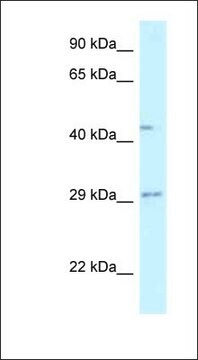 Anti-FUT8 antibody produced in rabbit affinity isolated antibody