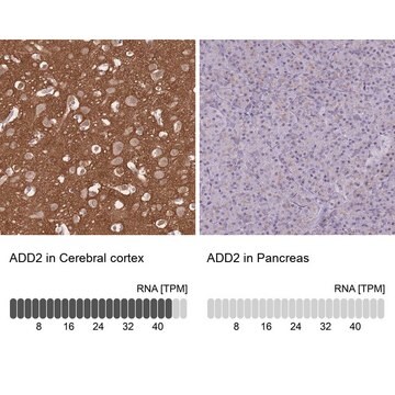 Anti-ADD2 antibody produced in rabbit Prestige Antibodies&#174; Powered by Atlas Antibodies, affinity isolated antibody, buffered aqueous glycerol solution