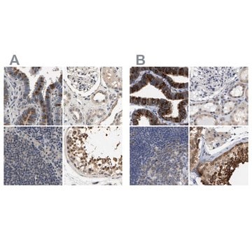 Anti-RUVBL1 antibody produced in rabbit Prestige Antibodies&#174; Powered by Atlas Antibodies, affinity isolated antibody, buffered aqueous glycerol solution, Ab2