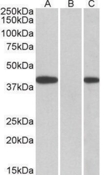 Anti-FANCF (C-terminal) antibody produced in goat affinity isolated antibody, buffered aqueous solution