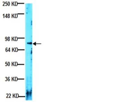 Anti-Laminin &#945;2-Antikörper, Klon 5H2 ascites fluid, clone 5H2, Chemicon&#174;