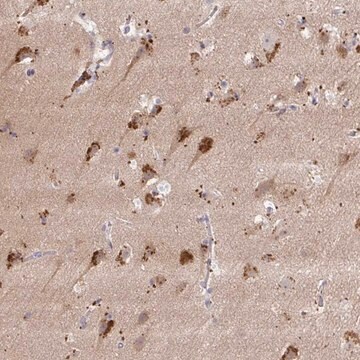 Anti-MAP1LC3A antibody produced in rabbit Prestige Antibodies&#174; Powered by Atlas Antibodies, affinity isolated antibody, buffered aqueous glycerol solution