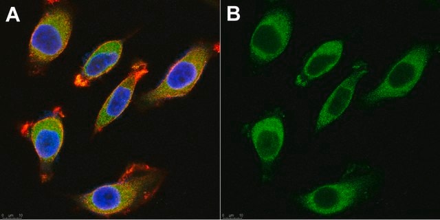 Anti-BACE1 Antibody, clone 3D5