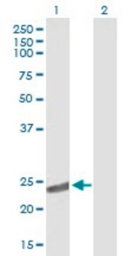 Anti-CRYBA2 antibody produced in mouse IgG fraction of antiserum, buffered aqueous solution