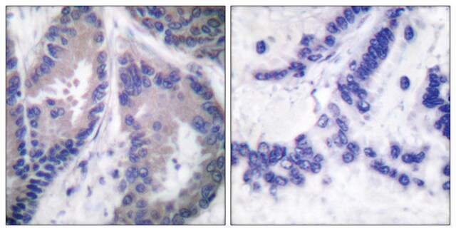 Anti-Collagen &#945;1 XVIII, C-Terminal antibody produced in rabbit affinity isolated antibody