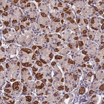 Anti-PLAC9 antibody produced in rabbit Prestige Antibodies&#174; Powered by Atlas Antibodies, affinity isolated antibody, buffered aqueous glycerol solution