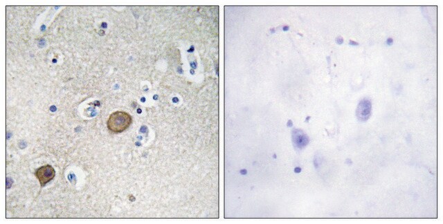 Anti-Catenin-&#945;1 antibody produced in rabbit affinity isolated antibody