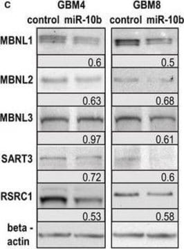 Anti-SART3 antibody produced in rabbit affinity isolated antibody