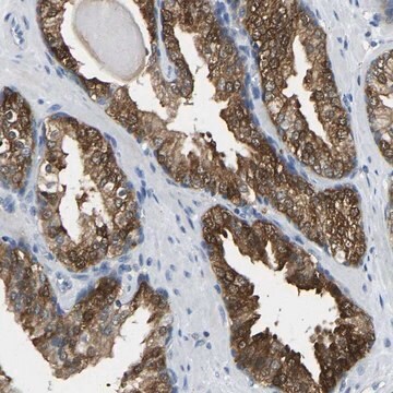 Anti-NDRG3 antibody produced in rabbit Prestige Antibodies&#174; Powered by Atlas Antibodies, affinity isolated antibody, buffered aqueous glycerol solution