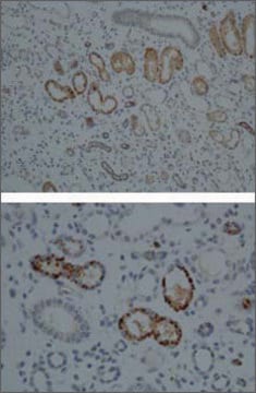 Anti-CYP1A1 (AB2) affinity isolated antibody