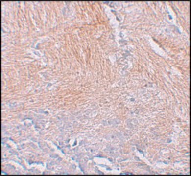 Anti-CXXC5 antibody produced in rabbit affinity isolated antibody, buffered aqueous solution