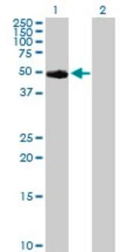 Anti-TYR antibody produced in rabbit purified immunoglobulin, buffered aqueous solution