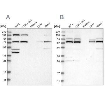 Anti-PLAA antibody produced in rabbit Prestige Antibodies&#174; Powered by Atlas Antibodies, affinity isolated antibody, buffered aqueous glycerol solution, Ab1