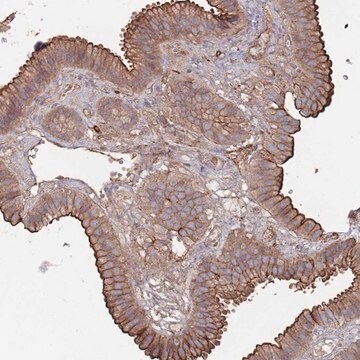 Anti-PLEKHA4 antibody produced in rabbit Prestige Antibodies&#174; Powered by Atlas Antibodies, affinity isolated antibody, buffered aqueous glycerol solution