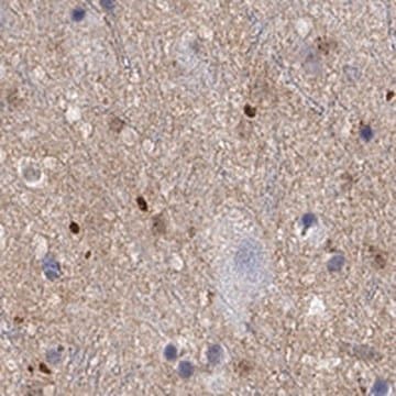 Anti-FGF2 antibody produced in rabbit Prestige Antibodies&#174; Powered by Atlas Antibodies, affinity isolated antibody, buffered aqueous glycerol solution