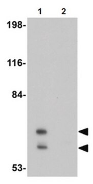 Anti-PICALM Antibody from rabbit, purified by affinity chromatography