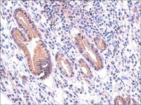 Anti-DUOX1 antibody produced in rabbit affinity isolated antibody, buffered aqueous solution