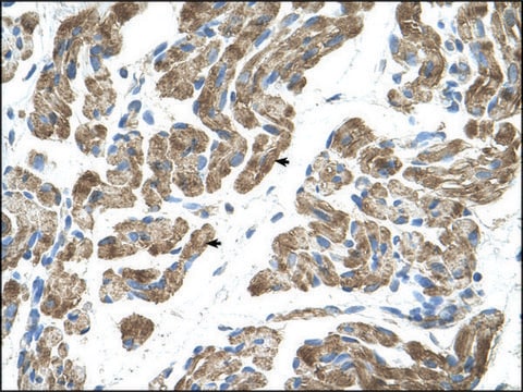 Anti-ACVR1 affinity isolated antibody