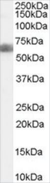 Anti-DKK3/REIC antibody produced in goat affinity isolated antibody, buffered aqueous solution