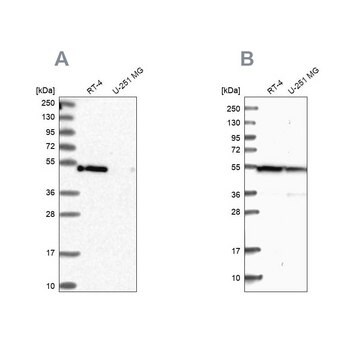 Anti-RASSF9 antibody produced in rabbit Prestige Antibodies&#174; Powered by Atlas Antibodies, affinity isolated antibody, buffered aqueous glycerol solution