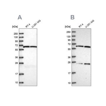 Anti-ACAD9 antibody produced in rabbit Prestige Antibodies&#174; Powered by Atlas Antibodies, affinity isolated antibody, buffered aqueous glycerol solution