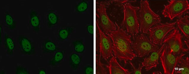 Anti-ARID2 antibody produced in rabbit affinity isolated antibody